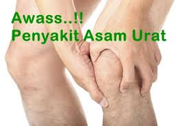 Illustration for article titled Obat Asam Urat dan Kolesterol